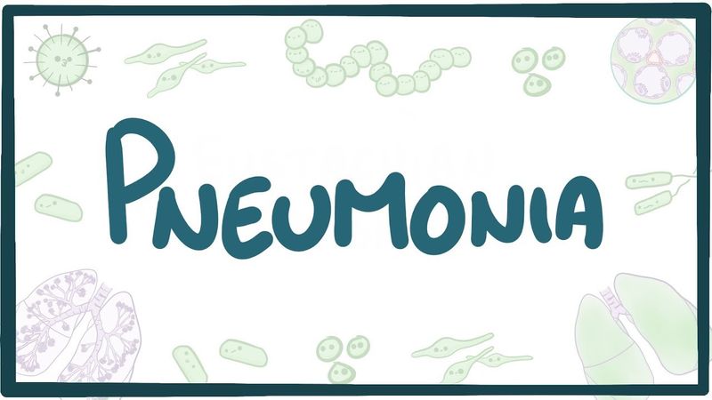 Pneumonia - causes, symptoms, diagnosis, treatment, pathology