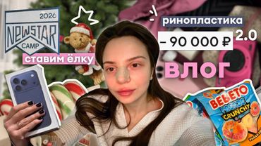 влог: повторная рино 👃🩶, winter arc ❄️, ставим ёлку 🎄✨ и готовлюсь к New Star Camp 🎿❄️