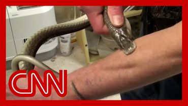 Man who injected himself with venom hundreds of times could revolutionize snakebite treatment