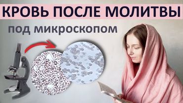 Как молитва влияет на здоровье.  🕊