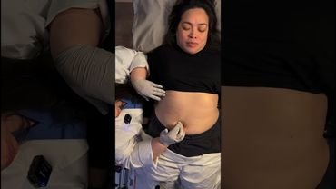 😴 Angelic Abdominal Assessment #asmr #asmrsleep #relax #sleepaid #asmrforsleep #trending #medical