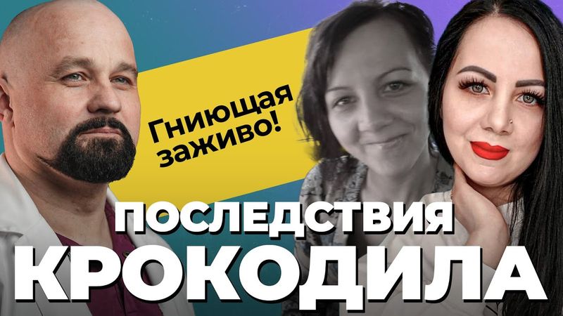 ИСПОВЕДЬ НАРКОМАНКИ: гнила заживо, инвалидность, вич, тюрьма! Последствия дезоморфина, соли, героина