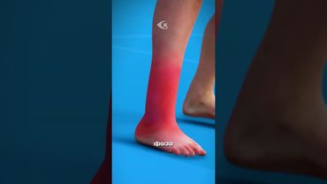 Что происходит, когда ты подворачиваешь ногу?