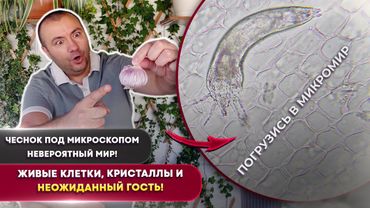 🧄 Чеснок под микроскопом | Живые клетки, шелуха, кристаллы и неожиданный луковый клещ