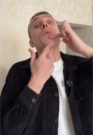 История шрамов Гурьянова #гурьянов #guryan_off #юмор #creatorsearchinsights