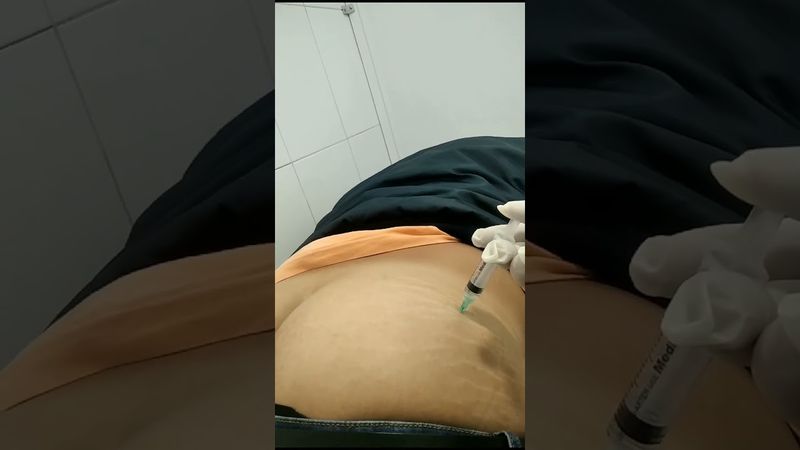 administración de medicamentos