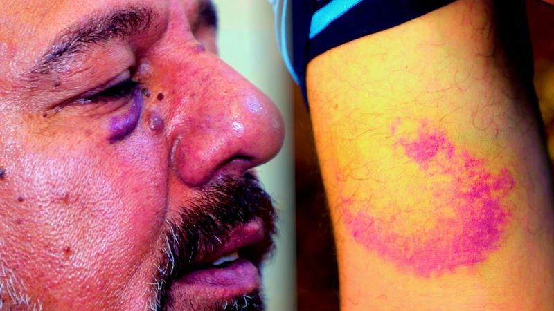 حلقة كاملة/شاب يطـ.عن ابوه بالســ.كين واشد انواع الـــ.ضرب بحق الام بسبب الســ.حر