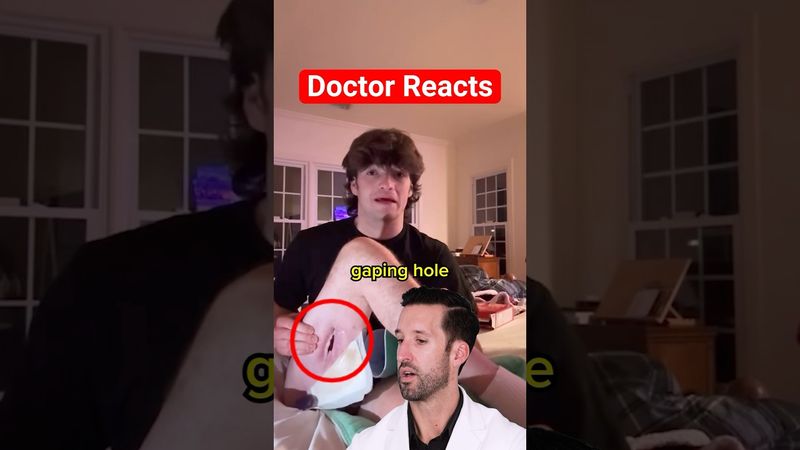 ER Doctor REACTS to Leg Hole