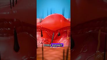 Как вытащить занозу 😮 #анатомия #anatomy #биология  #медицина