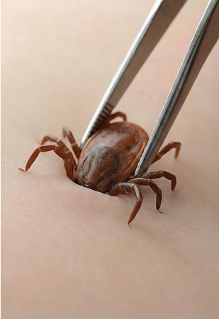 ¿Por qué NO debes jalar a una Garrapata? 😳 #homosapienstv #sabiasque 