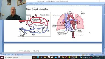 Trauma in Arabic 50 ( Septic Shock ) , by Dr. Wahdan .