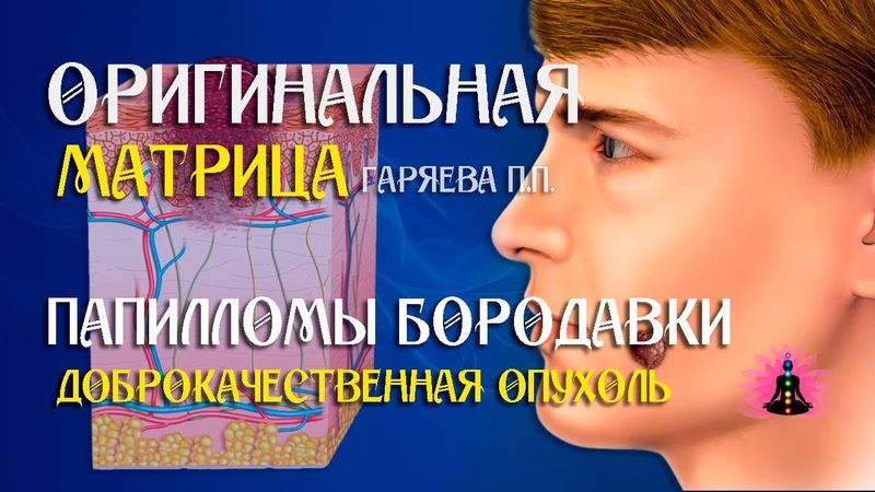 « Вирус папилломы, бородавки » ⚠️ Оригинальная матрица Гаряева П.П ☀️ SoftRadio.ru