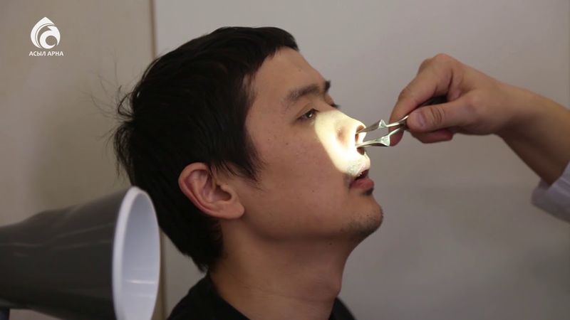 Полипы в носовой полости \ Семейный доктор \ Асыл арна