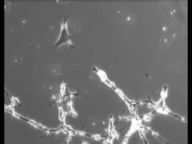 Замедленная съёмка нейронов, формирующих новые связи. Примерно так выглядят ваши мысли