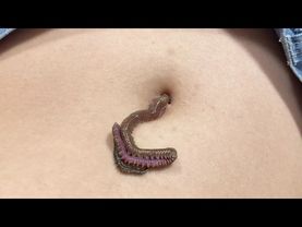 【閲覧注意】【虫注意】【worm】おへそにイソメ入れる