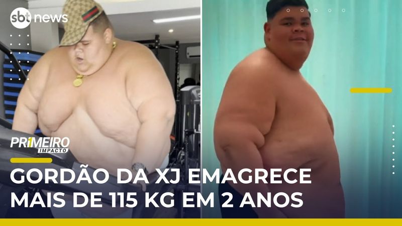 Gordão da XJ perde 115 kg em dois anos e se prepara para cirurgia bariátrica | #PrimeiroImpacto