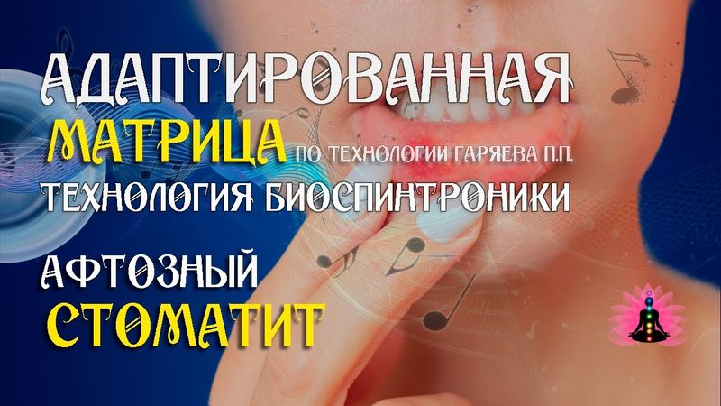 Афтозный стоматит 🎶 программа матрица по технологии Гаряева П.П ☀️ SoftRadio.ru