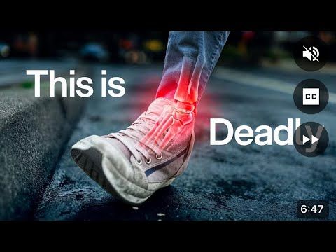 Насколько слабы твои кости? (Тест и решение) Брайан Джонсон на русском