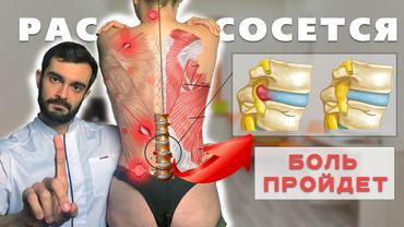 Как ГРЫЖА исчезнет. БОЛЬ в спине и шее пройдет, ЕСЛИ… l ПОЛНОЕ РУКОВОДСТВО