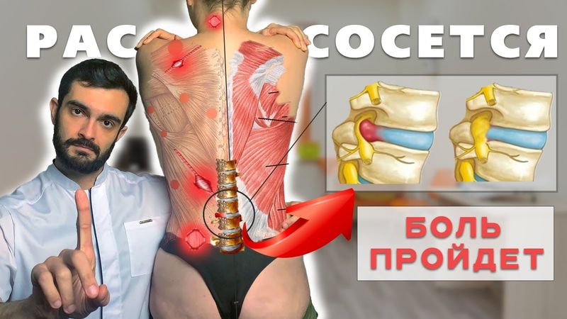 Как ГРЫЖА исчезнет. БОЛЬ в спине и шее пройдет, ЕСЛИ… l ПОЛНОЕ РУКОВОДСТВО