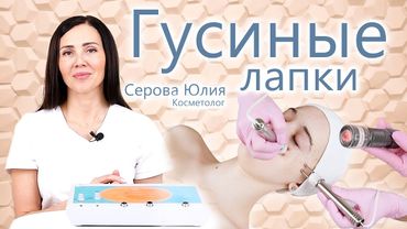 🔬 Морщины вокруг глаз. Что такое Гусиные Лапки? Морщины. Косметолог Серова Юлия. ЭСМА.