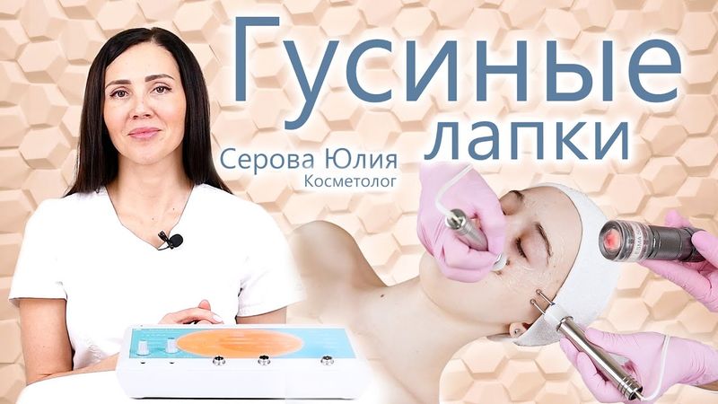 🔬 Морщины вокруг глаз. Что такое Гусиные Лапки? Морщины. Косметолог Серова Юлия. ЭСМА.