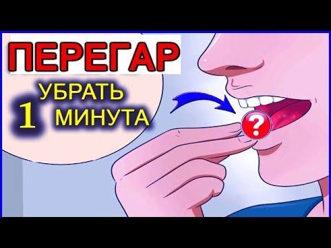ПЕРЕГАР - КАК БЫСТРО ИЗБАВИТЬСЯ ОТ ЗАПАХА (13 способов)