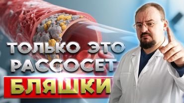 The plaques will dissolve! The whole TRUTH about Atherosclerosis