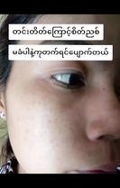 တင်းတိတ်ကြောင်စိတ်ညစ်မခံပါနဲ့ကုတက်ရင်ပျောက်ပါတယ်#တင်းတိတ် #တင်းတိတ်အမ...