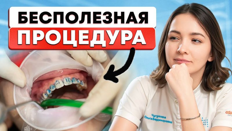 НЕ СОГЛАШАЙТЕСЬ НА ПРОФЕССИОНАЛЬНУЮ ГИГИЕНУ! Стоматологи молчат об этом