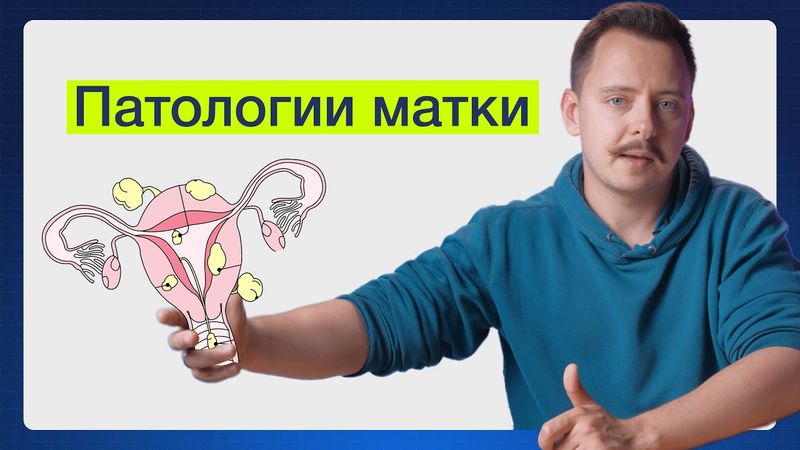 Как я встретил вашу матку и нашел в ней заболевание