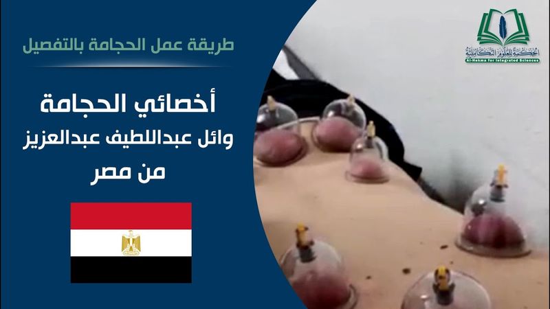 طريقة عمل الحجامة بالتفصيل | المعالج وائل عبداللطيف عبدالعزيز من مصر