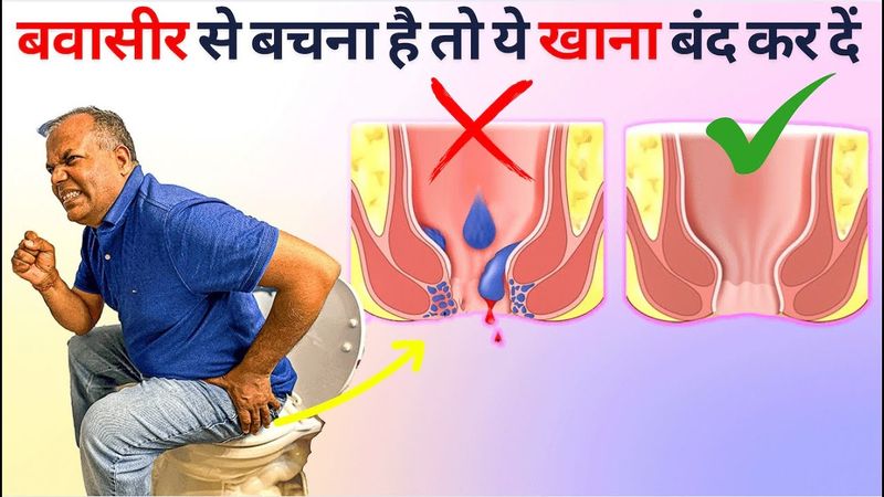 Why You Got Piles - STOP Eating These FOODS आज से ये खाना बंद कर दें- बवासीर और भगन्दर @LABatHOME