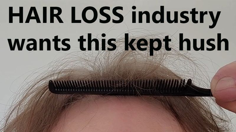 Regrow Hair Sucessfully, NO products or drugs, even late stage