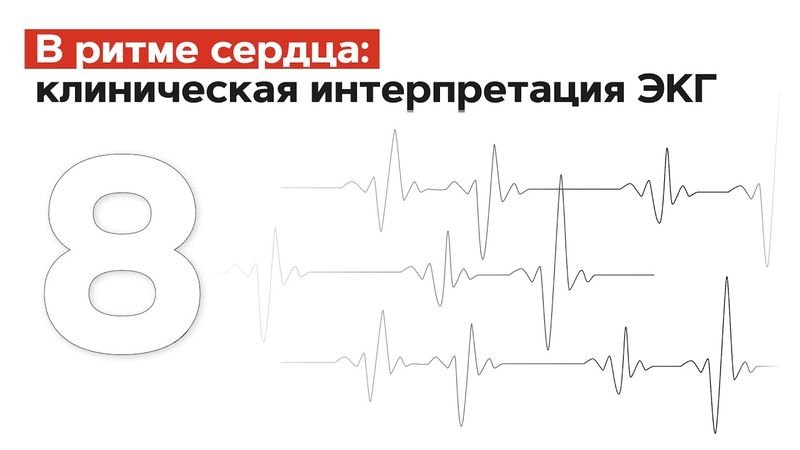 ЭКГ у больного с ожирением . 05.07.22