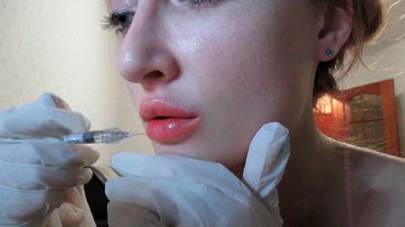 увеличение губ гиалуроновой кислотой в домашних условиях