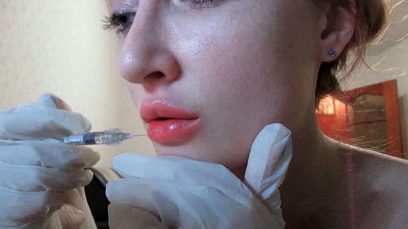 увеличение губ гиалуроновой кислотой в домашних условиях