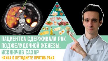 Реальный случай: как одна пациентка использовала кето-диету против рака поджелудочной железы