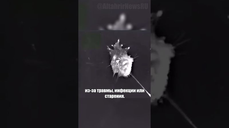 Как погибают нейроны и как их заменяют другие