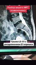 #больвпояснице#грыжапозвоночника #мртпозвоночника