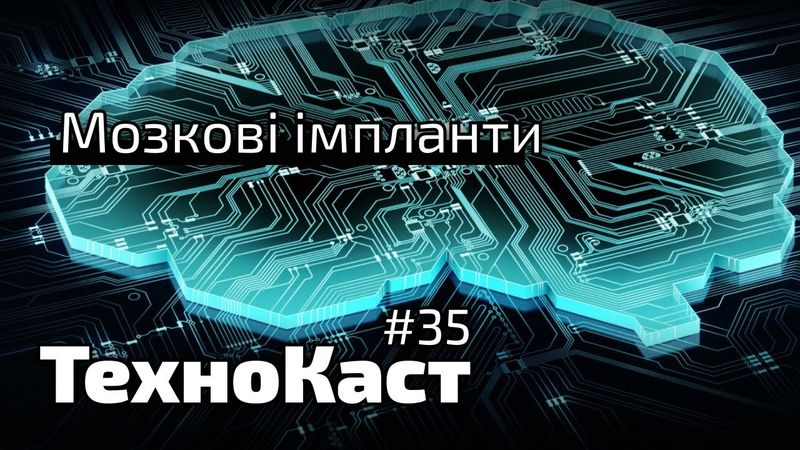 Мозкові імпланти, суд за чіти, CES-2022. Технокаст №35
