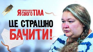 Личинки на спідній білизні – Я соромлюсь свого тіла | МЕДИЦИНА | ЛІКАРІ | ЗДОРОВ’Я