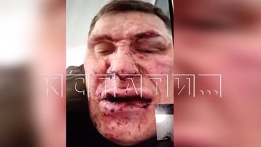 Чемпион России по пауэрлифтингу получил удар ножом от постояльца, но переломал ему ноги