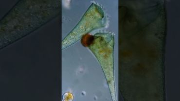 Стенторы — микроскопические великаны