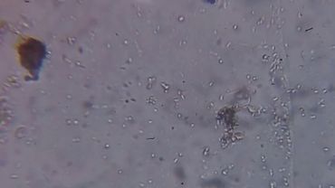 Бактерии под микроскопом.