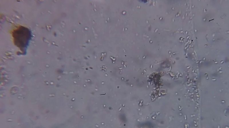 Бактерии под микроскопом.