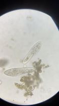 amazing monsters that I found in the snow in a microscope #microscope...