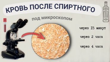Водка, коньяк - как влияют на состояние крови