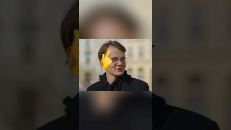 Штефанов и облысение