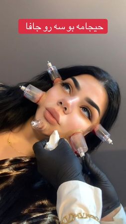 #07512428816 #زاخو_دهوك_هولير_سليماني_ئاكري_سيمي #dill_beauty #دليرحي...